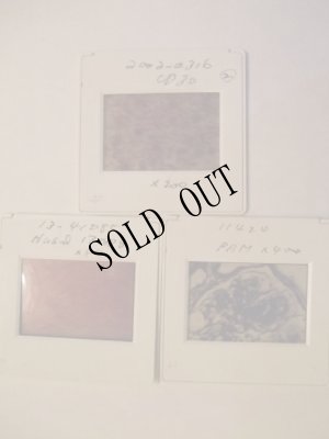 画像2: 懐古物医療フィルム (2)